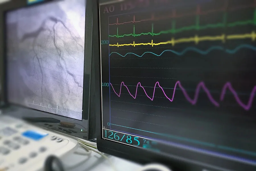 Laboratory-Testing-Ekg-Or-Ecg-Lab-Test-In-Tampa-Florida